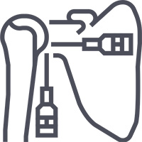 Drive Tech Advisors - Icono - Cirugia Artroscopica de Hombro Drive Tech Advisors - Icono - Cirugia Artroscopica de Hombro