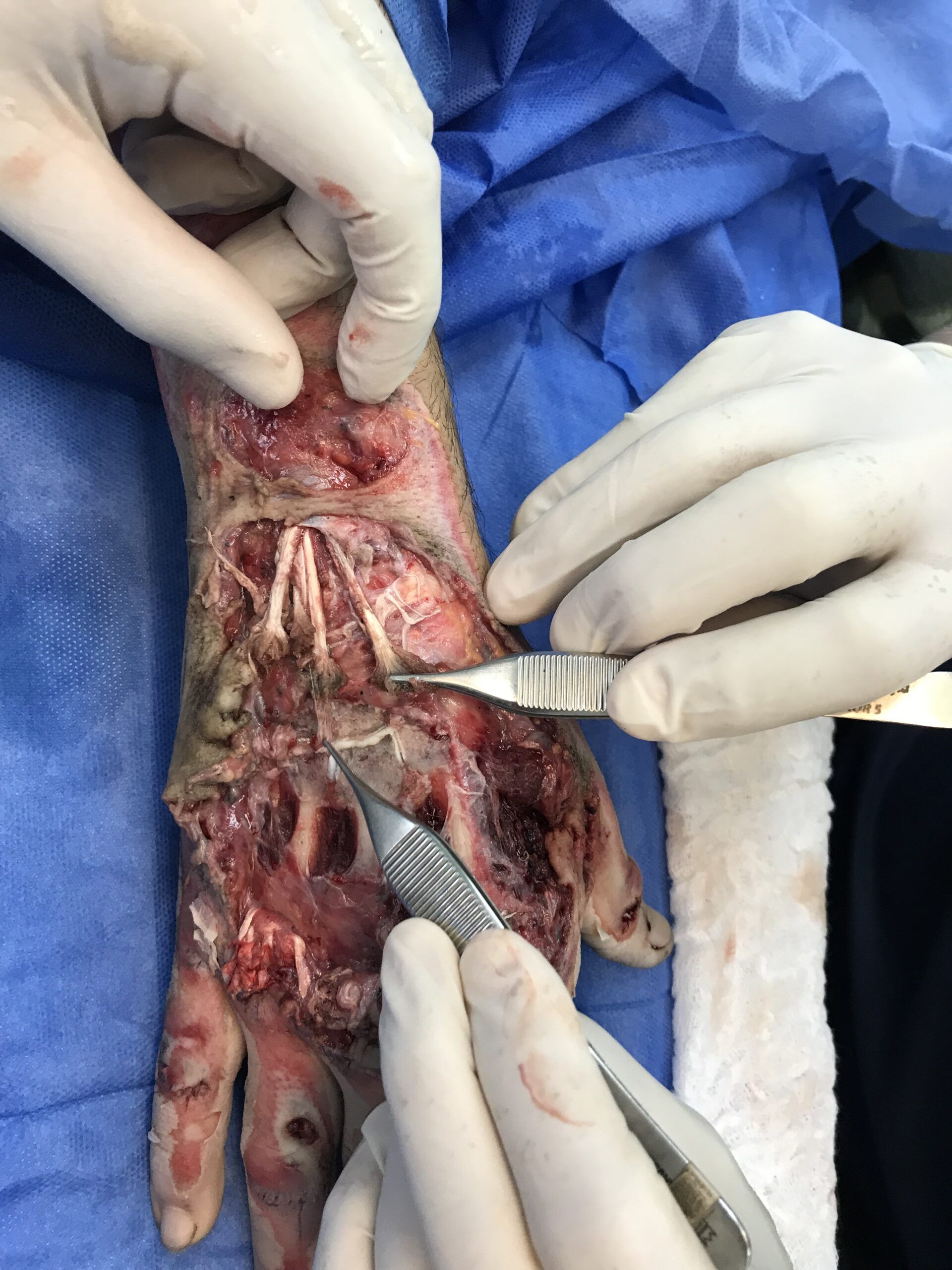 DTA - Foto - Dr. Fernando Gonzalez Mundarain - Traumatologo - Cirujano de la mano