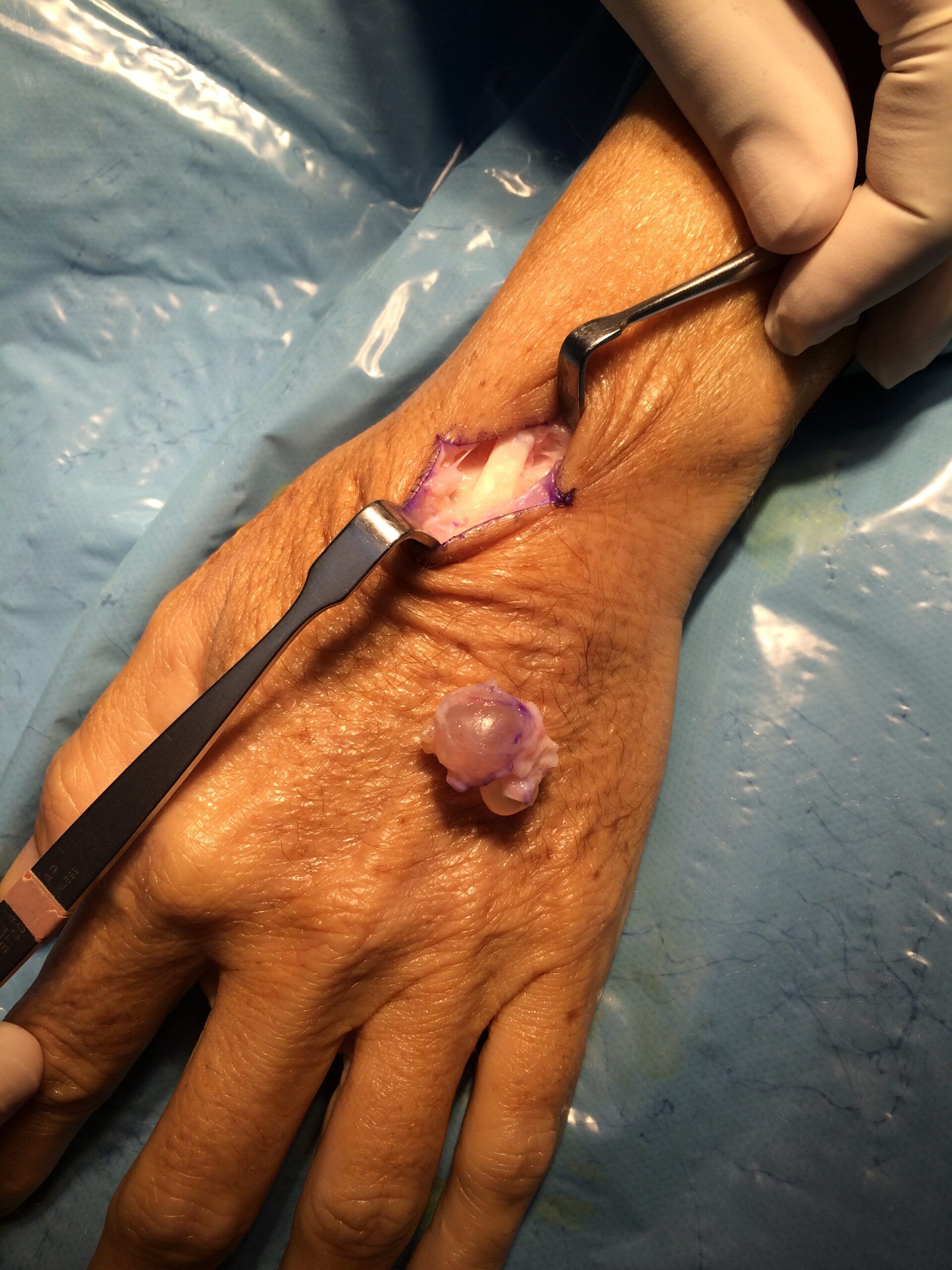 DTA - Foto - Dr. Fernando Gonzalez Mundarain - Traumatologo - Cirujano de la mano