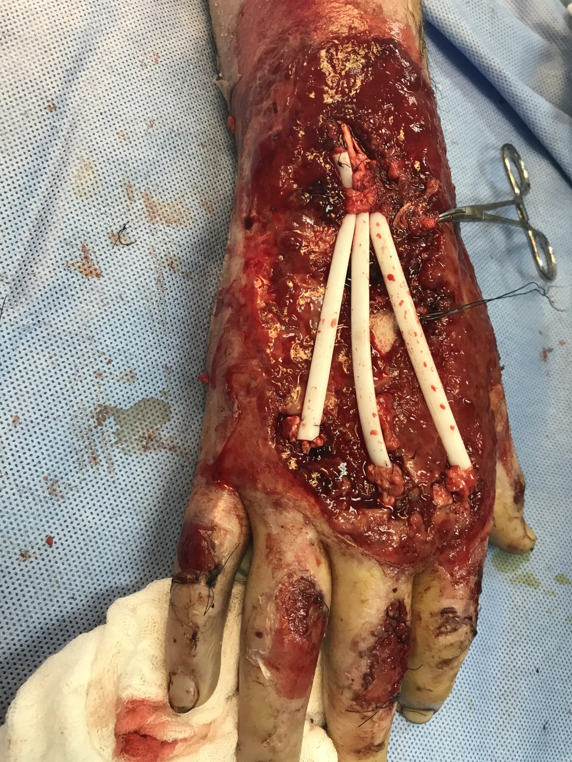 DTA - Foto - Dr. Fernando Gonzalez Mundarain - Traumatologo - Cirujano de la mano