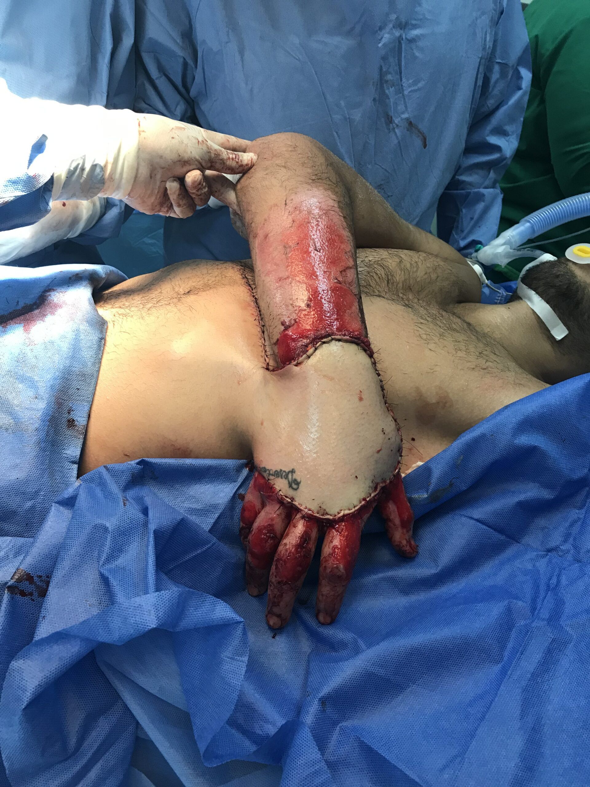 DTA - Foto - Dr. Fernando Gonzalez Mundarain - Traumatologo - Cirujano de la mano