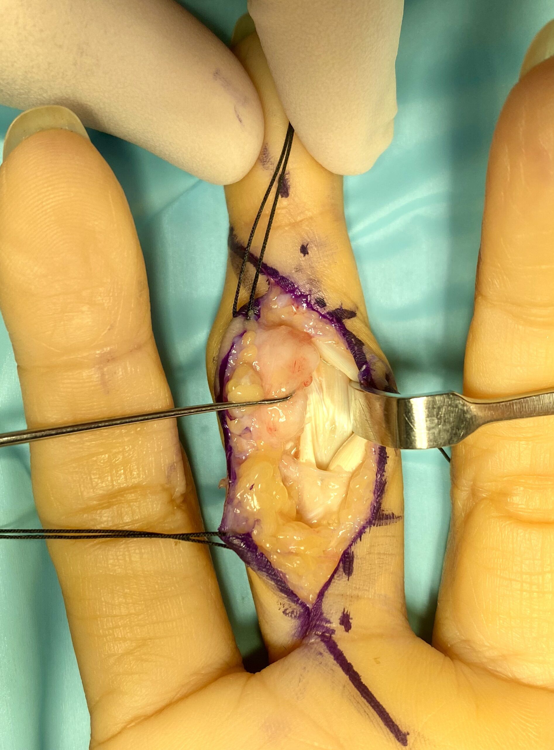 DTA - Foto - Dr. Fernando Gonzalez Mundarain - Traumatologo - Cirujano de la mano