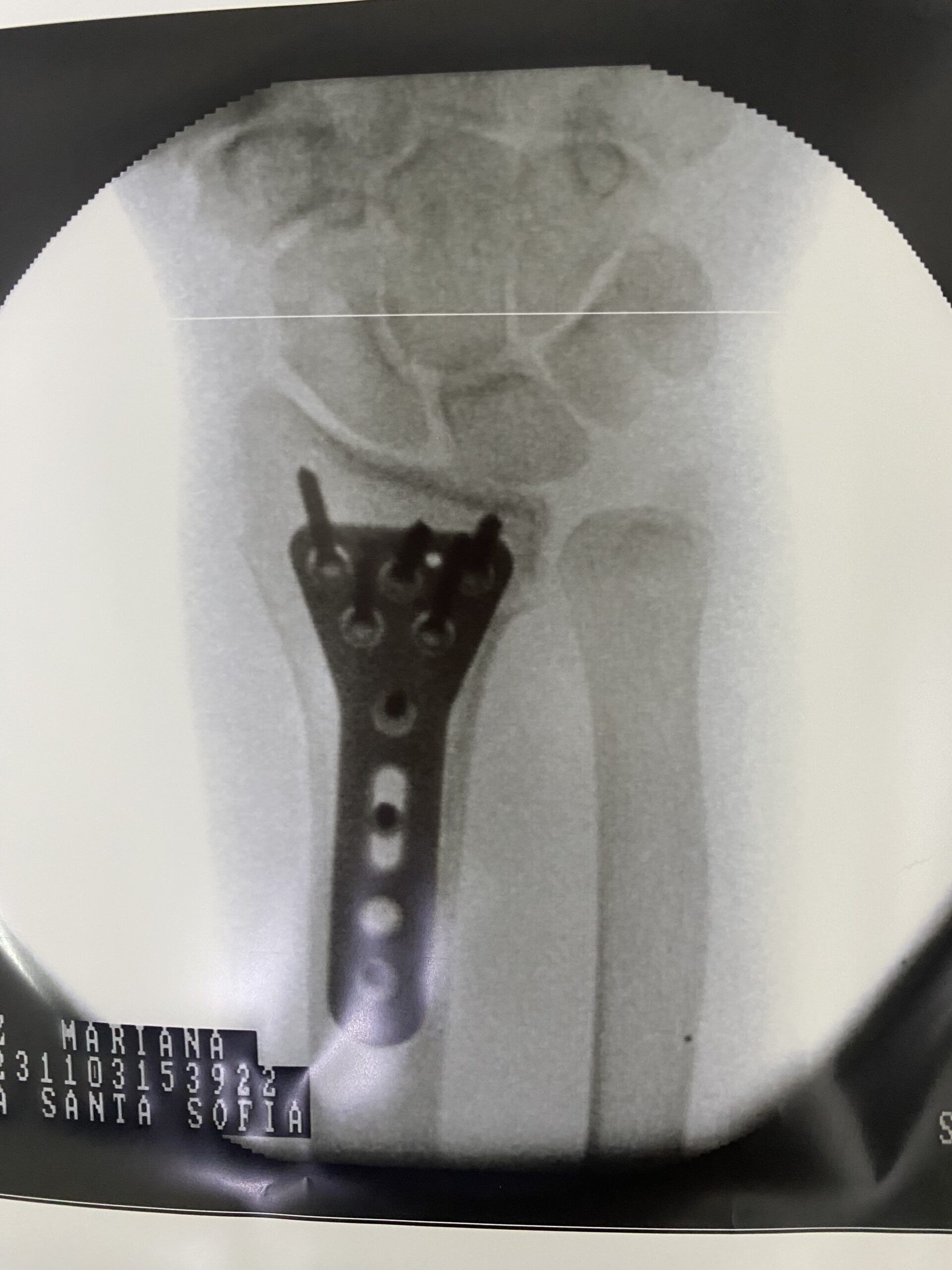 DTA - Foto - Dr. Fernando Gonzalez Mundarain - Traumatologo - Cirujano de la mano