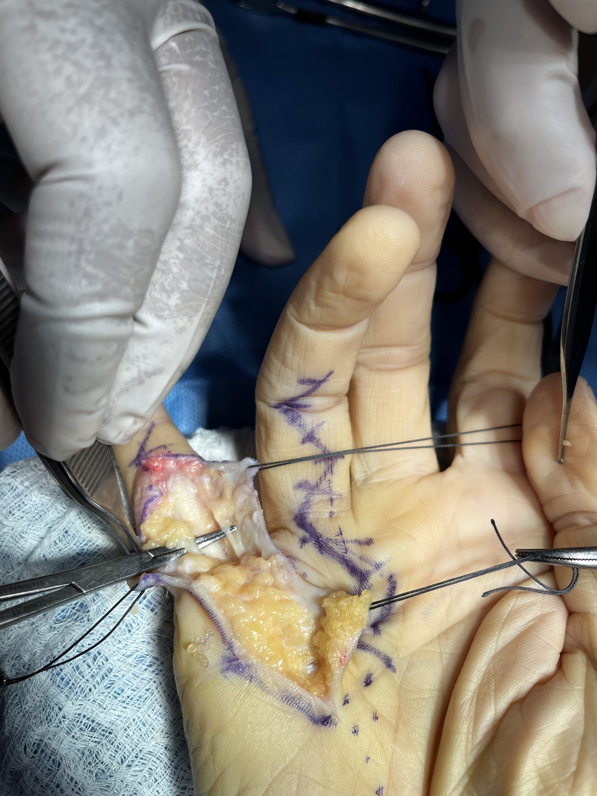 DTA - Foto - Dr. Fernando Gonzalez Mundarain - Traumatologo - Cirujano de la mano