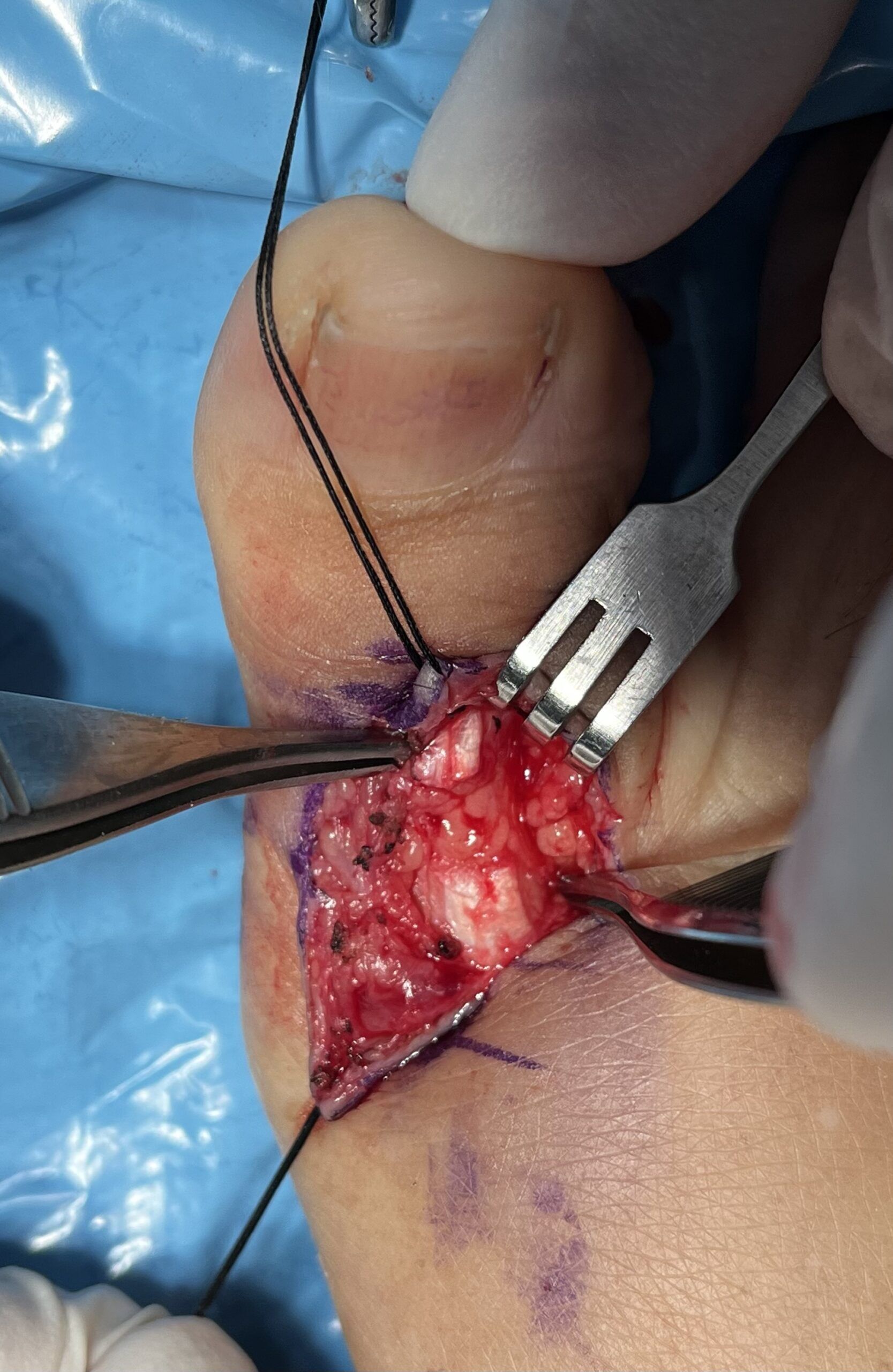 DTA - Foto - Dr. Fernando Gonzalez Mundarain - Traumatologo - Cirujano de la mano