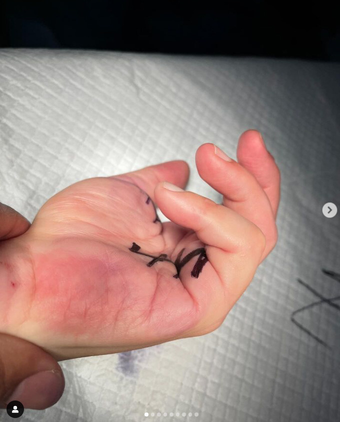 DTA - Foto - Dr. Fernando Gonzalez Mundarain - Traumatologo - Cirujano de la mano