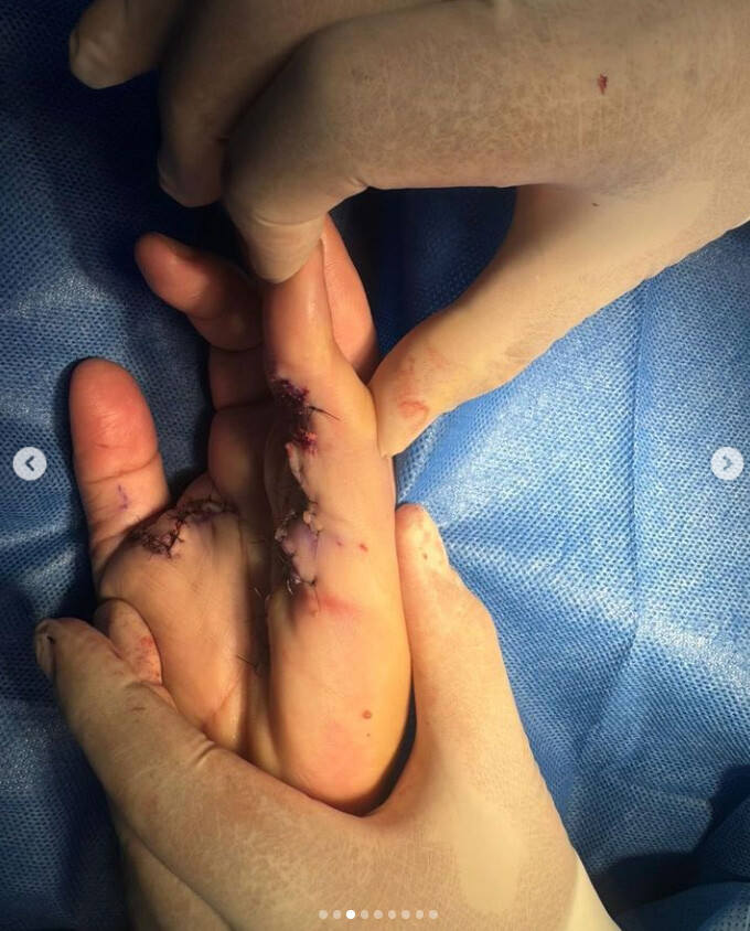 DTA - Foto - Dr. Fernando Gonzalez Mundarain - Traumatologo - Cirujano de la mano