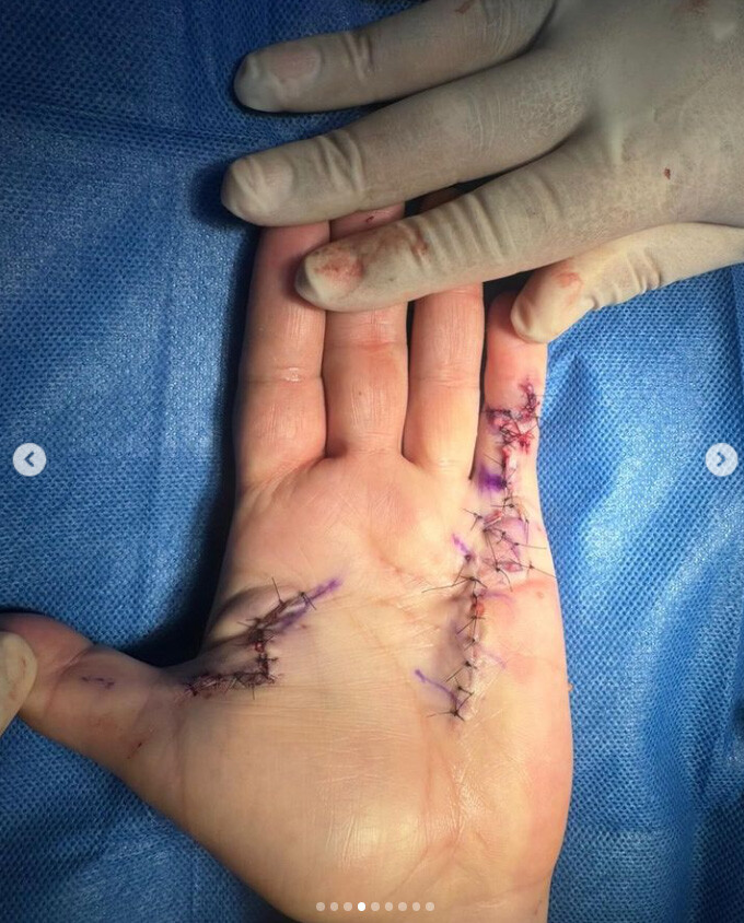 DTA - Foto - Dr. Fernando Gonzalez Mundarain - Traumatologo - Cirujano de la mano