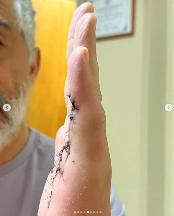 DTA - Foto - Dr. Fernando Gonzalez Mundarain - Traumatologo - Cirujano de la mano