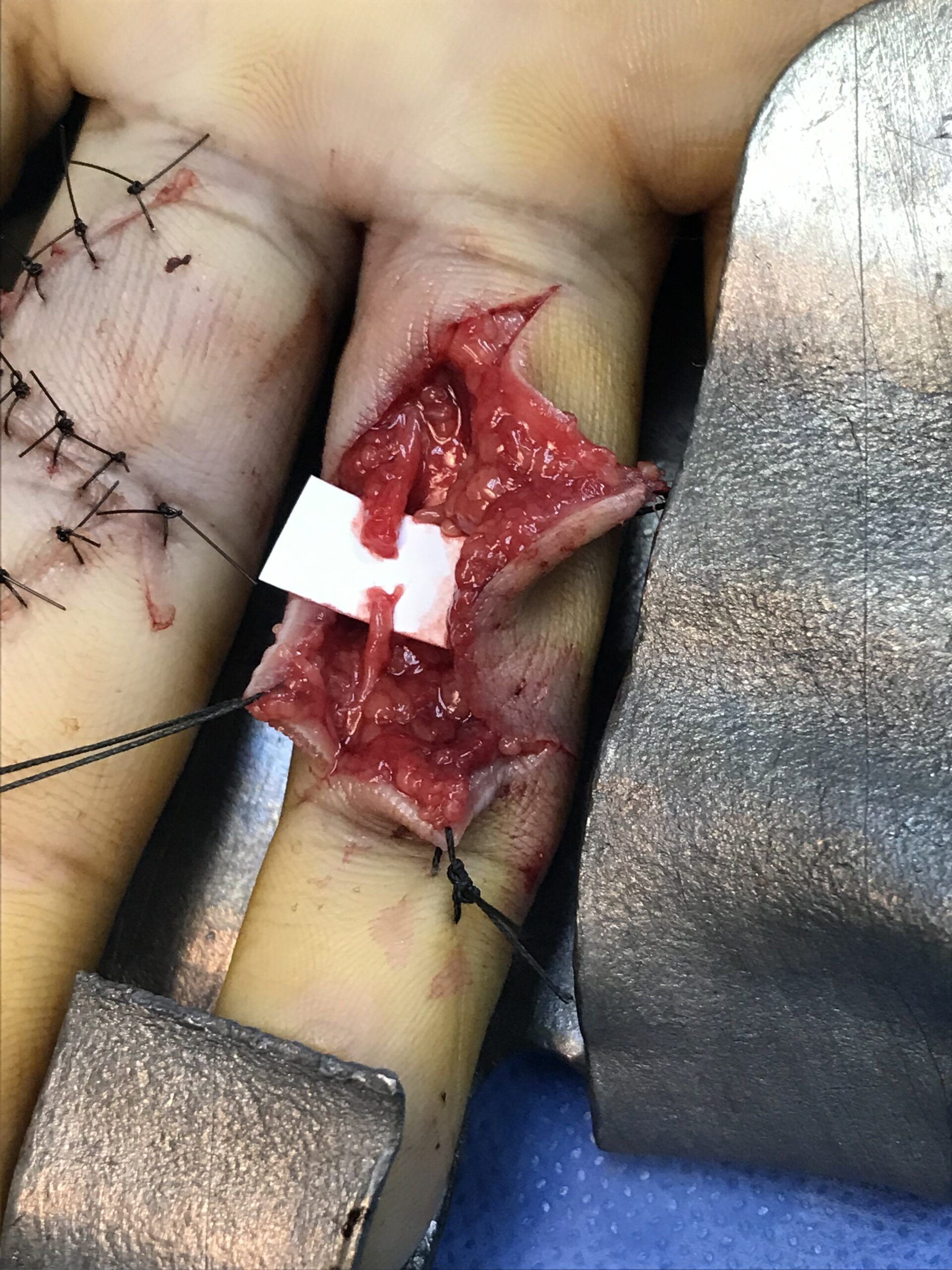 DTA - Foto - Dr. Fernando Gonzalez Mundarain - Traumatologo - Cirujano de la mano