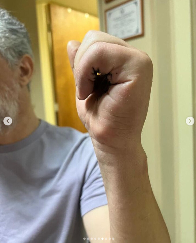 DTA - Foto - Dr. Fernando Gonzalez Mundarain - Traumatologo - Cirujano de la mano