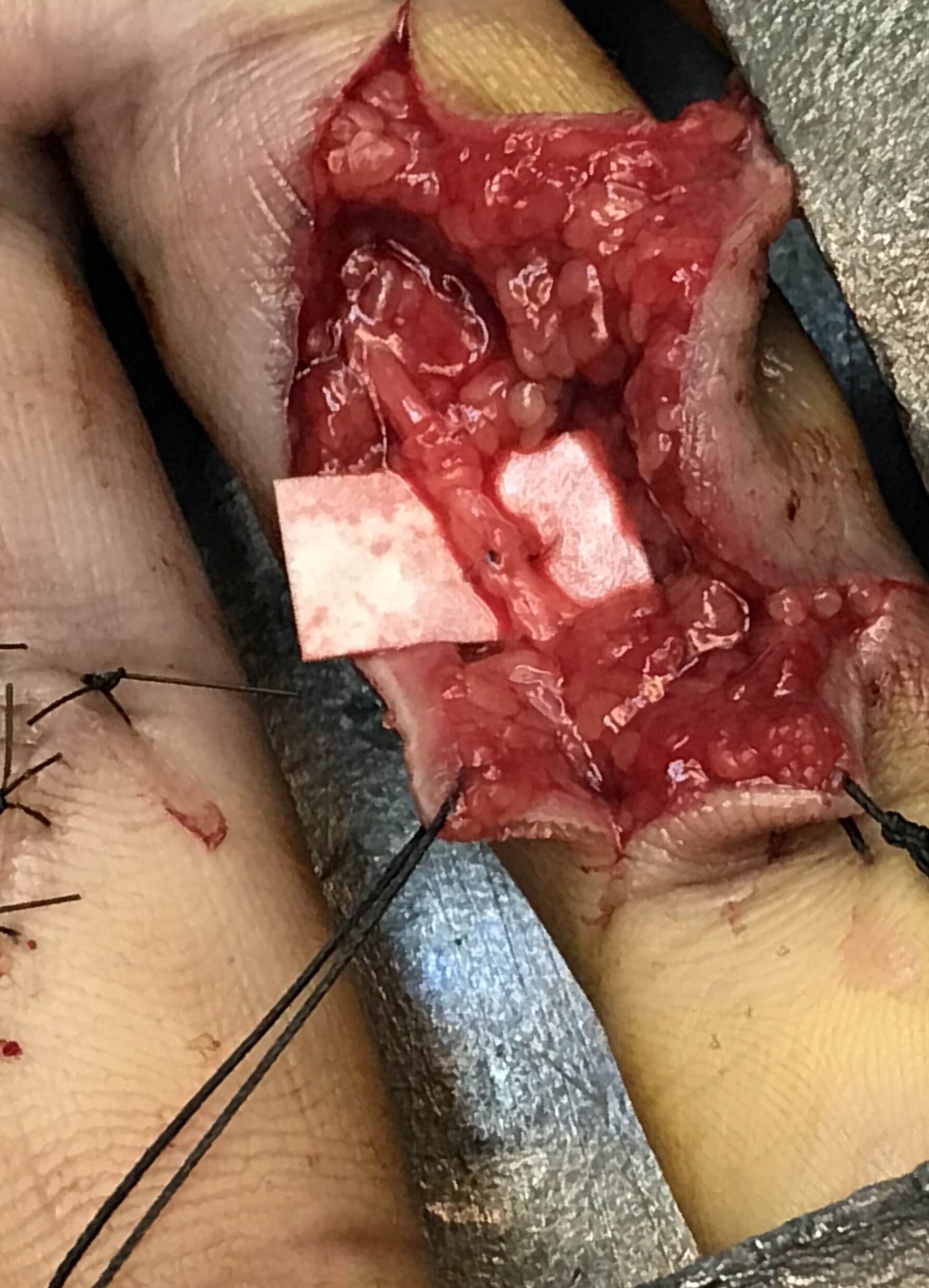 DTA - Foto - Dr. Fernando Gonzalez Mundarain - Traumatologo - Cirujano de la mano