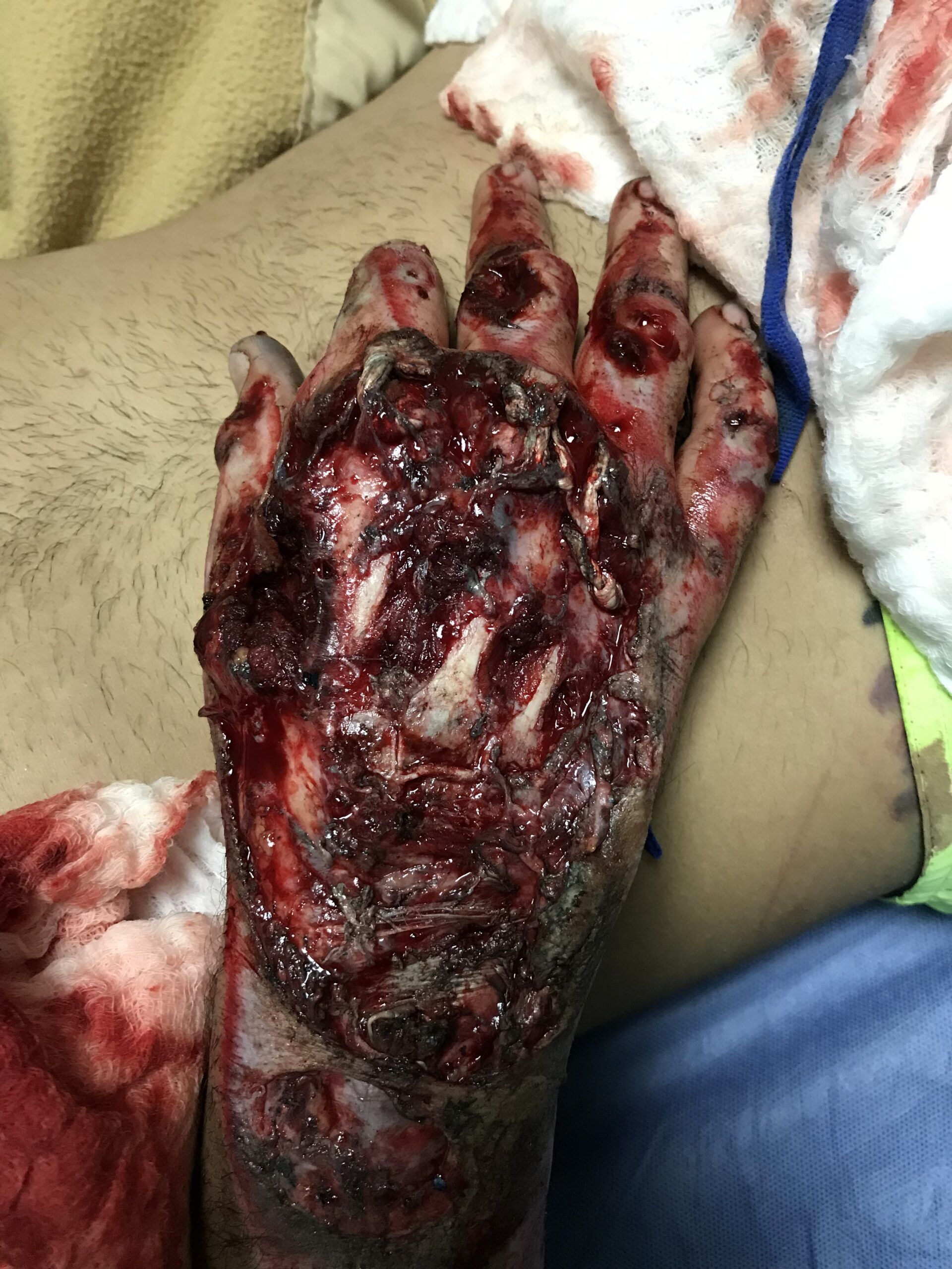 DTA - Foto - Dr. Fernando Gonzalez Mundarain - Traumatologo - Cirujano de la mano